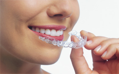 Invisalign Petalum Orthodontics